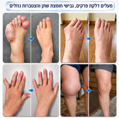 💎חנות רשמית | Solaroza® רול-און מיקרו-מחטים 0.05 מ״מ להקלה מהירה בכאבי פרקים ועצמות 🦴